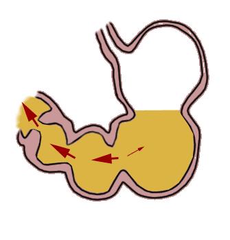 胃病怎么得来的粤语,胃病是怎么来的中医解答