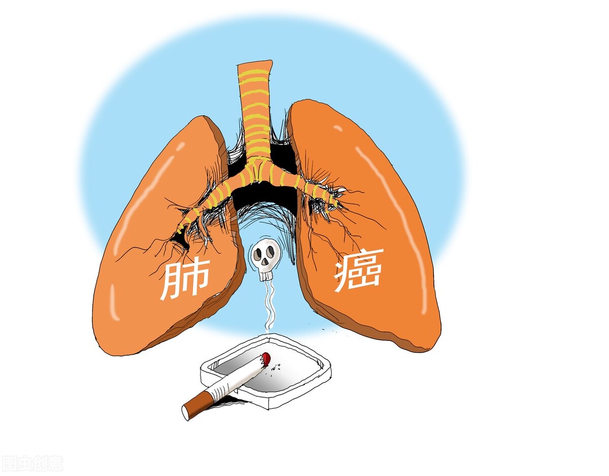 早期癌症治愈率在90%以上,癌症治愈率90%是完全可治好吗
