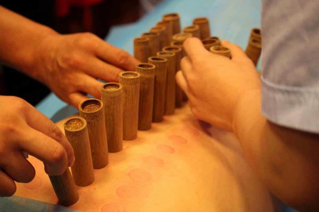 这个季节适合养膘不适合减肥,养生不养膘秋季减肥吃什么