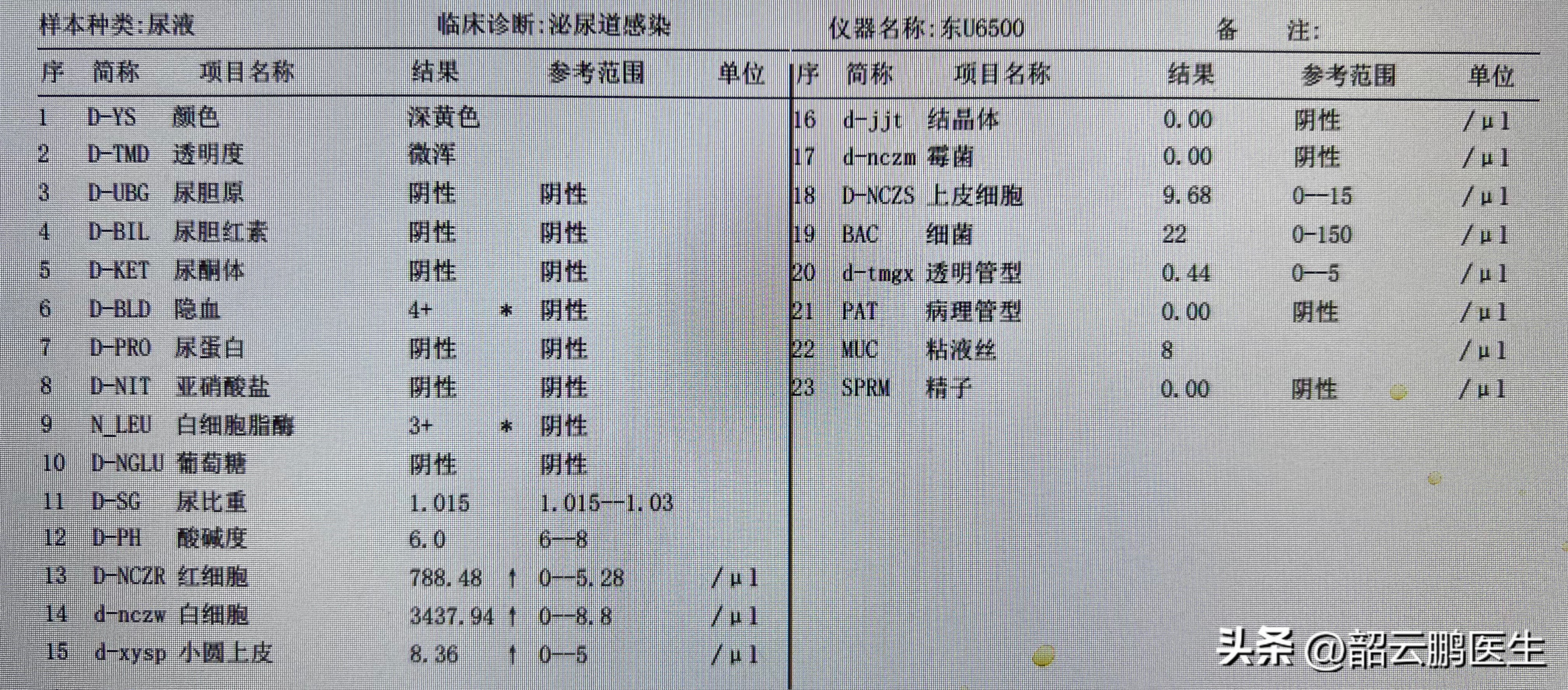 尿常规可以发现哪些异常,尿常规有两个加号代表什么