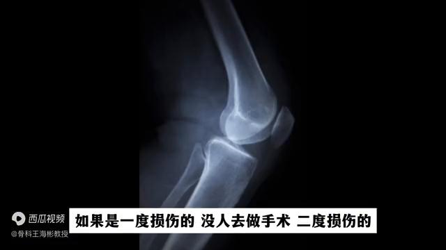 半月板损伤不做手术有什么好办法,半月板二度损伤静养三周变成三度