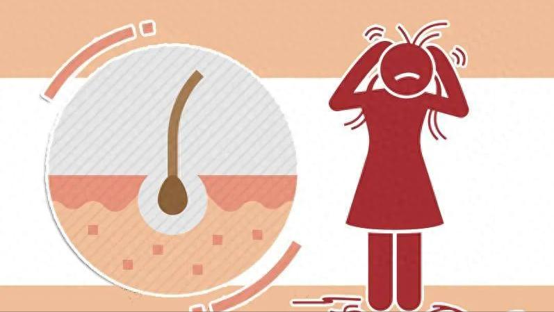 为什么头皮总长小疙瘩用什么药,为啥头皮上起脓包