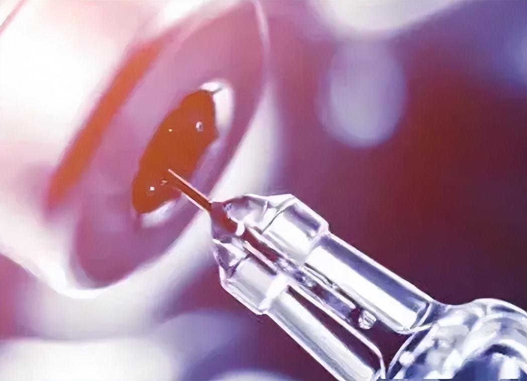 剖宫产手术，不同的全身麻醉方法有啥区别？对胎儿健康影响不同！