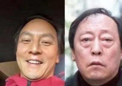 有哪些明星头发秃顶,秃顶明星发际线