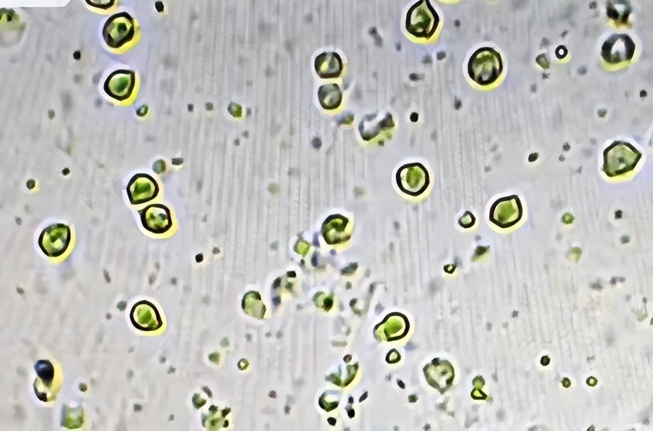 前列腺常规检查报告单正常,前列腺核磁共振报告单怎么解读