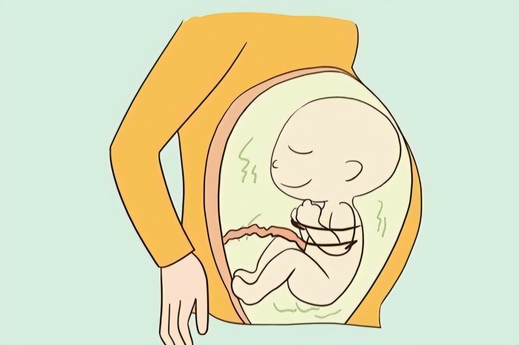 怀孕后孕吐严重怎么办,怀孕11周晚上孕吐严重