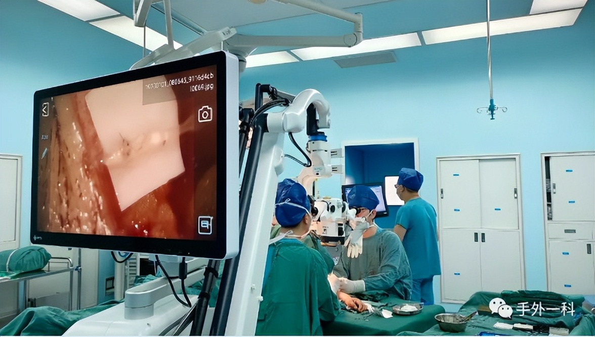 兵器工业521医院常规开展肿瘤术后淋巴水肿治疗手术