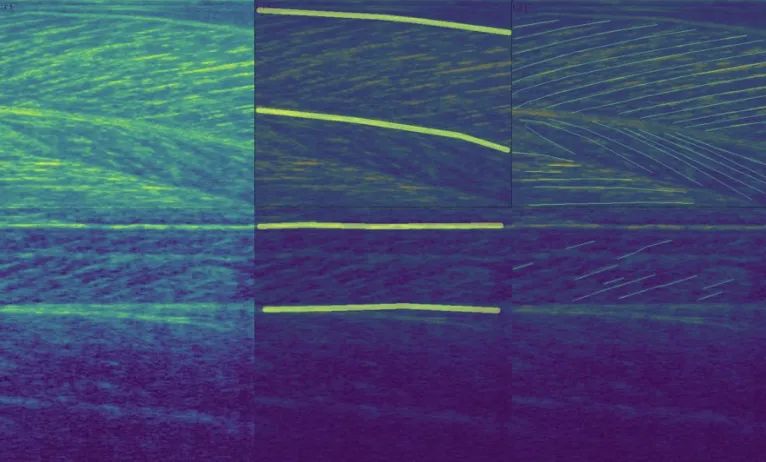 医学影像目标检测框架,开源数据集目标检测