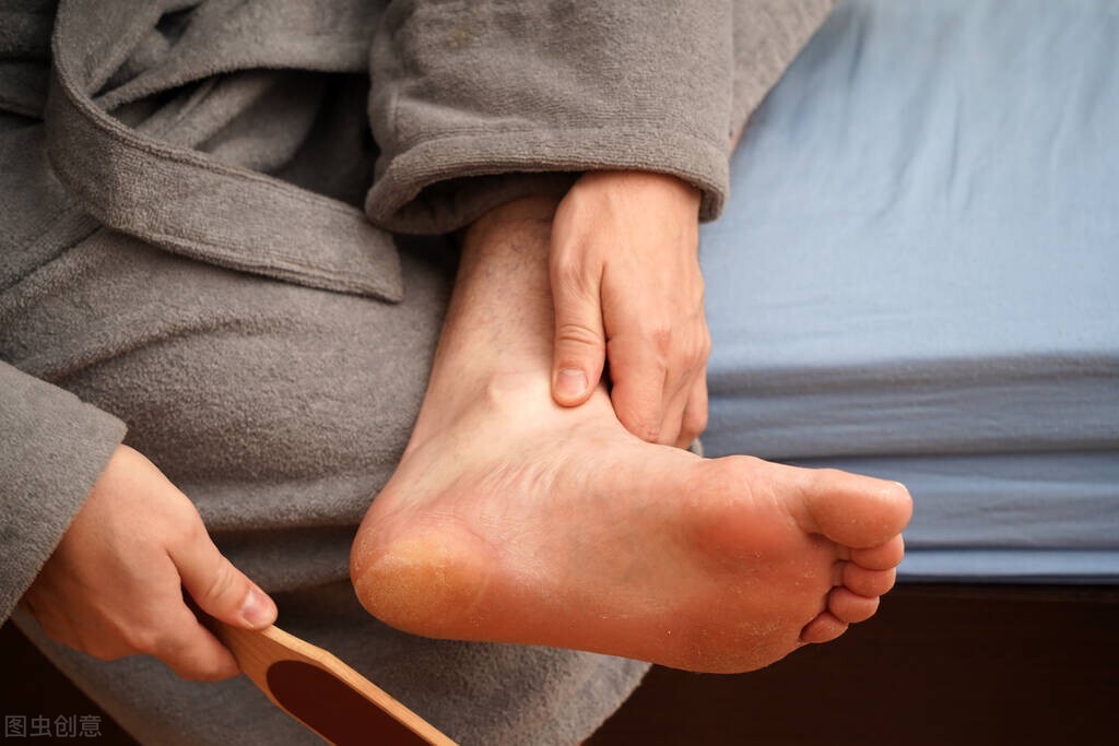 30岁后脚跟皲裂就治不好么,30岁脚干裂是怎么回事