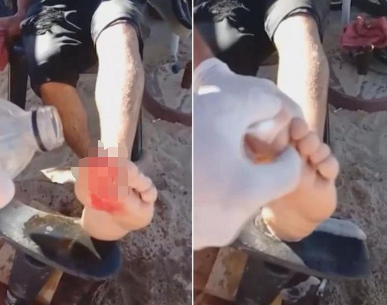 巴西球员被食人鱼吃剩骨,巴西球员惨遭食人鱼