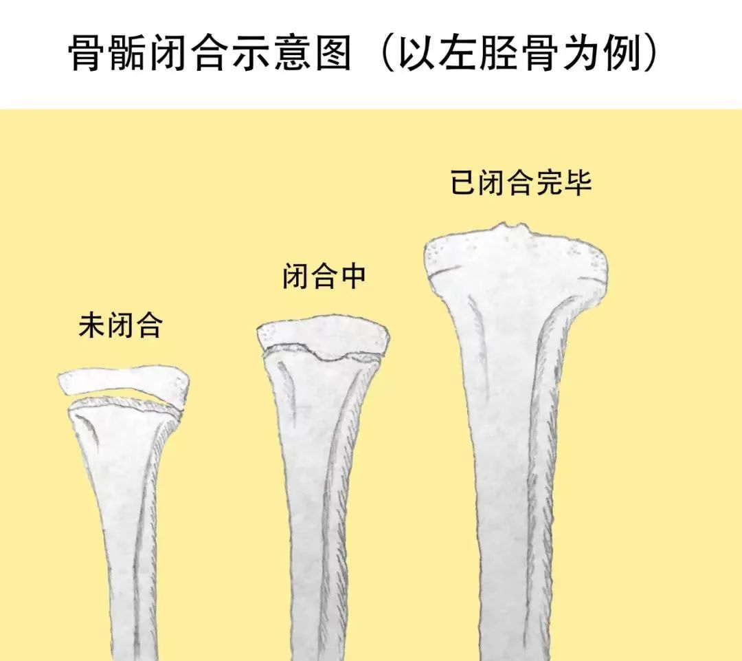 如何帮助孩子长得更高,家长如何做能让孩子长的比较高