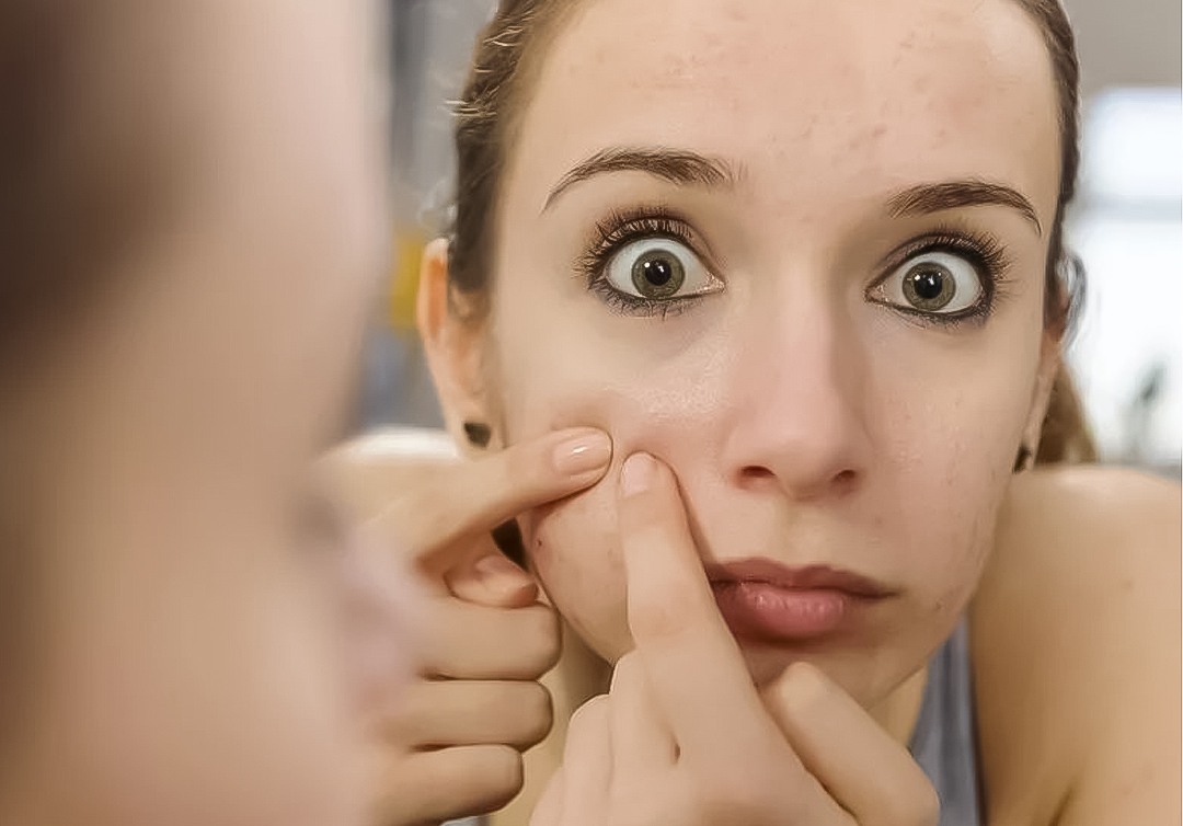 清滋颜：粉刺鼓包疼痛难受挤不住来怎么办？这里有高效处理方法