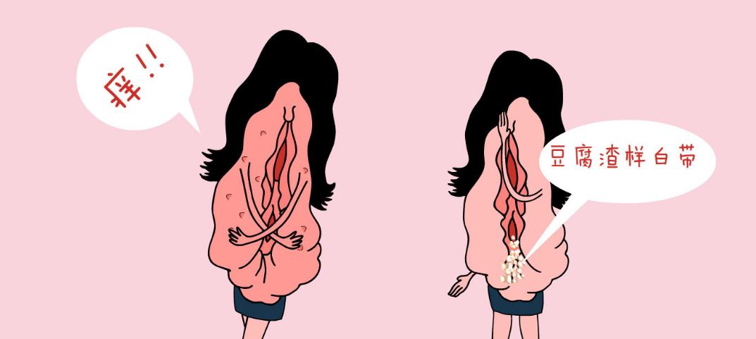 妇科疾病外阴瘙痒,女士外阴瘙痒是什么原因引起的