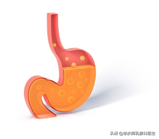 全麻不能吃饭不能喝水,全麻手术前喝了一点点水有事吗