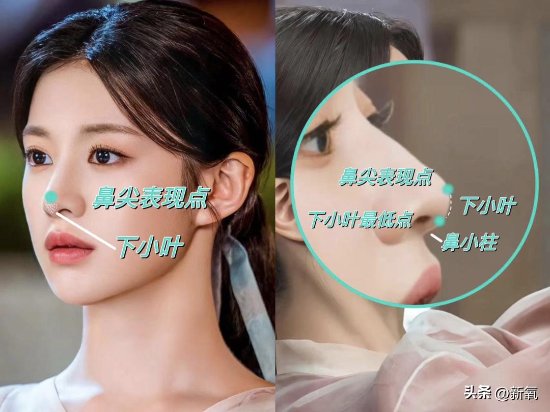改一点赢很大？她整完鼻子直接美成断代神颜…