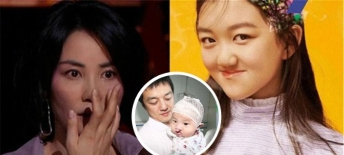王菲女儿唇裂是哪个医生做的,王菲女儿兔唇怎么治好
