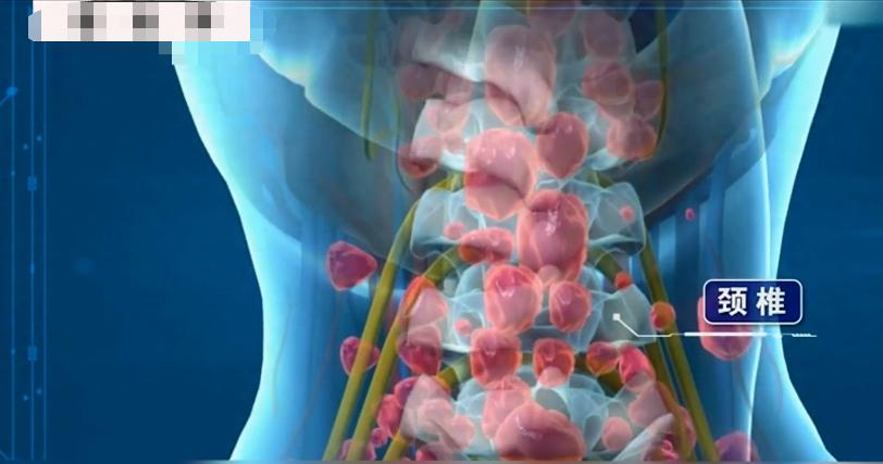 女孩体内4000多肿瘤,女孩体内上千肿瘤结果怎么样了