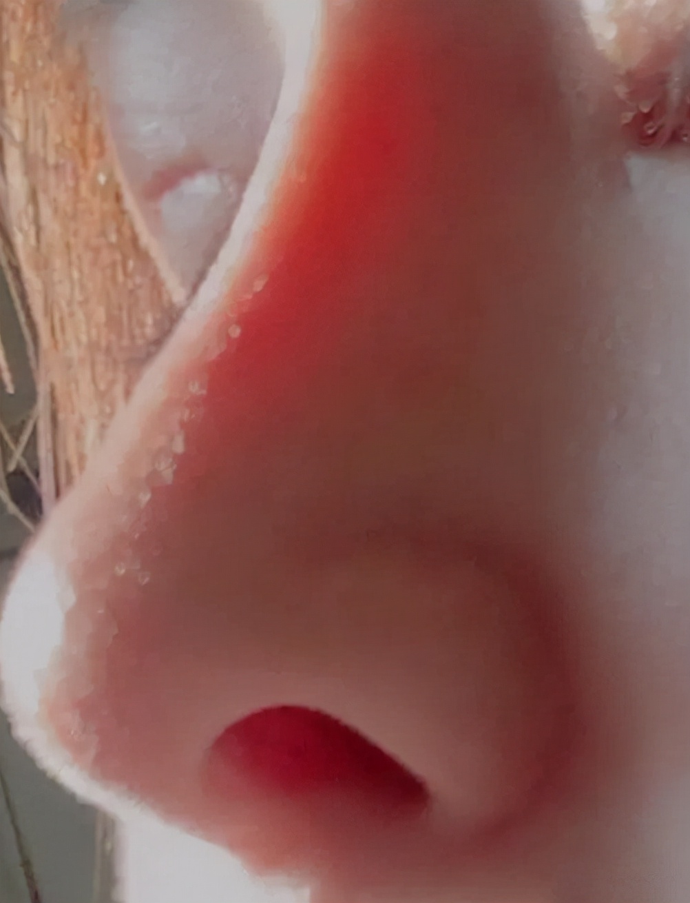 整形中的“假体”可以永久留存在体内吗？是否会伤害身体？