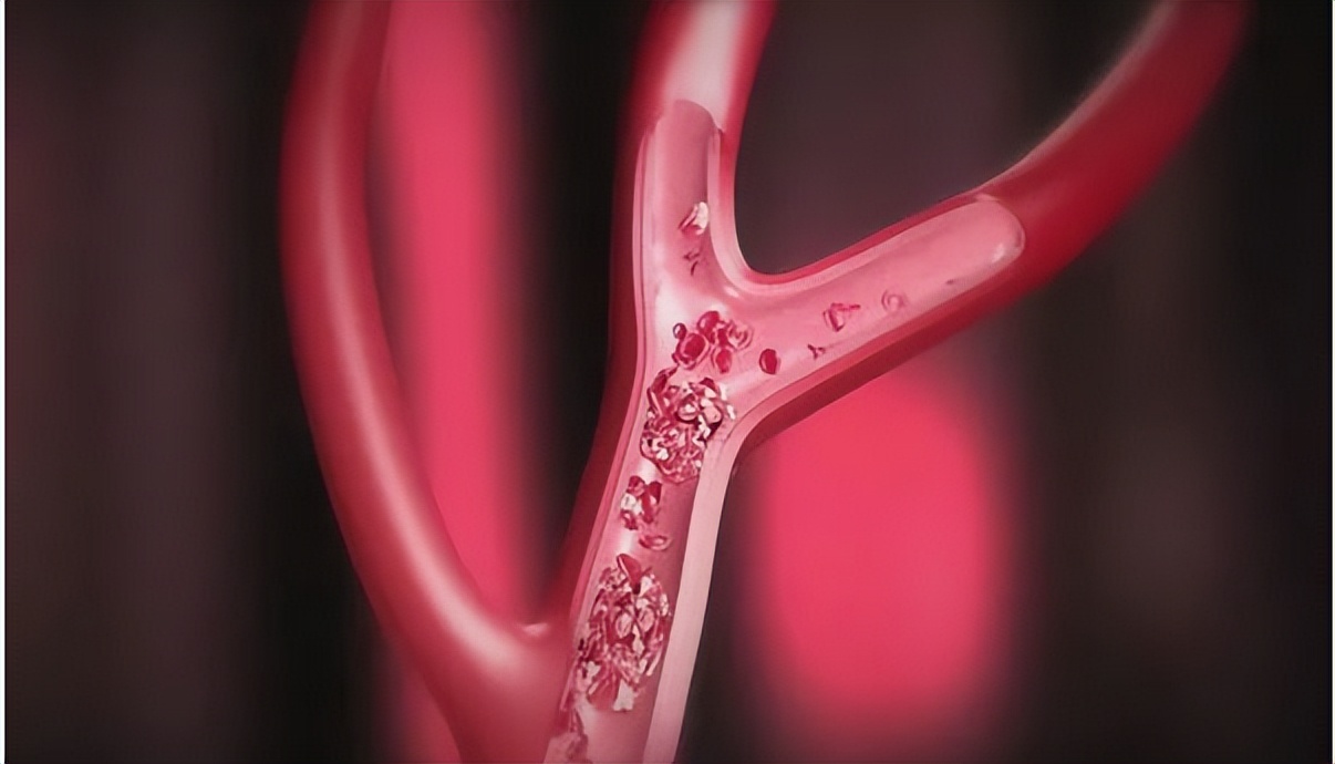 前列腺理疗什么意思,前列腺理疗是什么意思