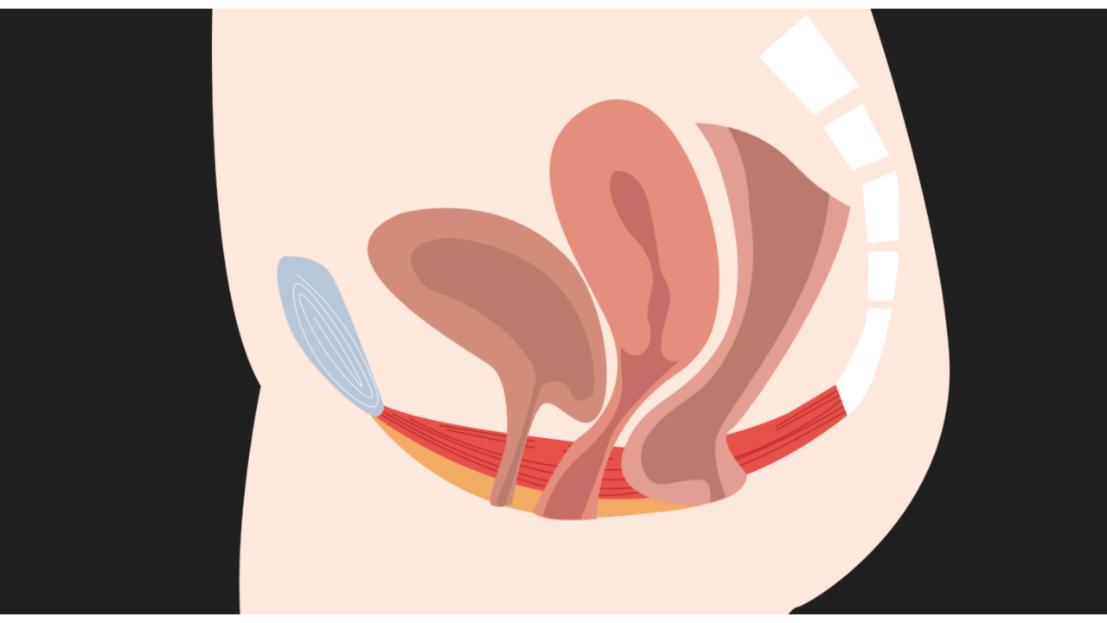 注意性缺陷多动障碍临床表现,注意功能障碍属于什么障碍