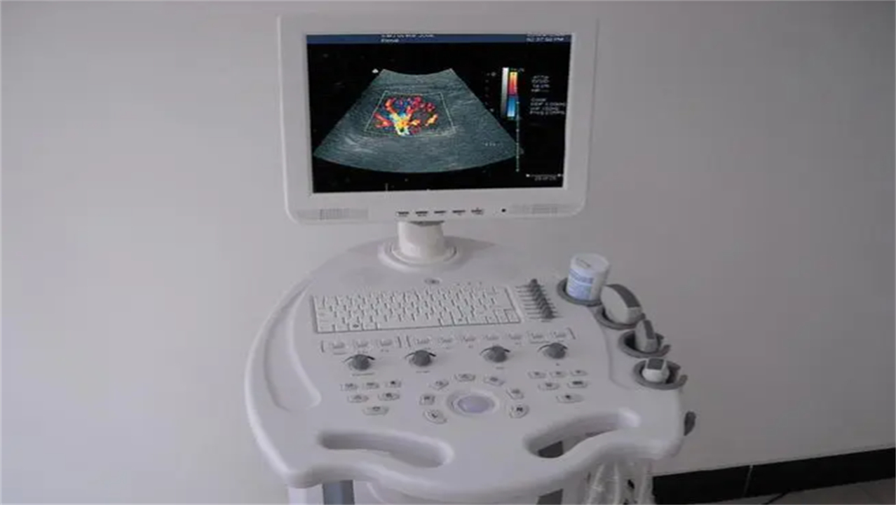 泌尿系统的彩超检查是什么,腹部彩超及泌尿系统彩超注意事项