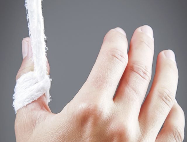 第一掌骨基底部骨折手法复位,骨折手法复位原理