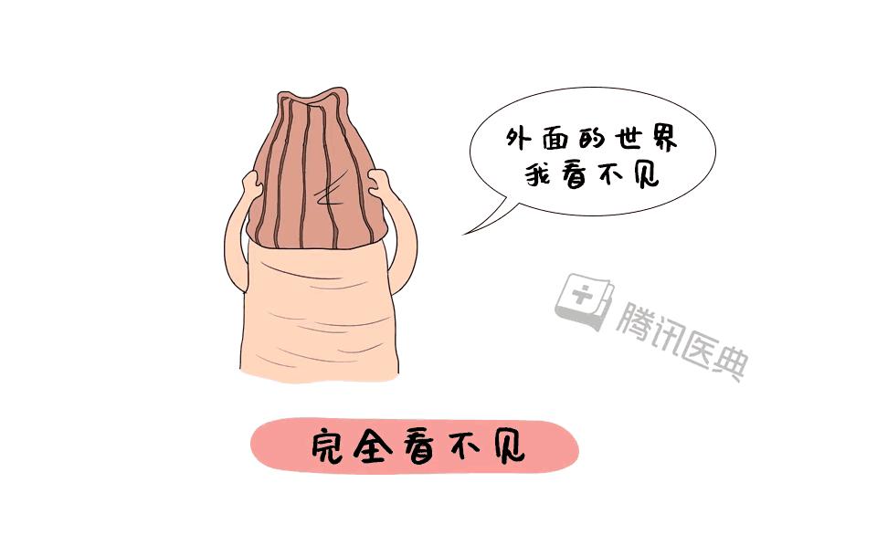 割完包皮后要恢复多久,割完包皮之后要多久恢复