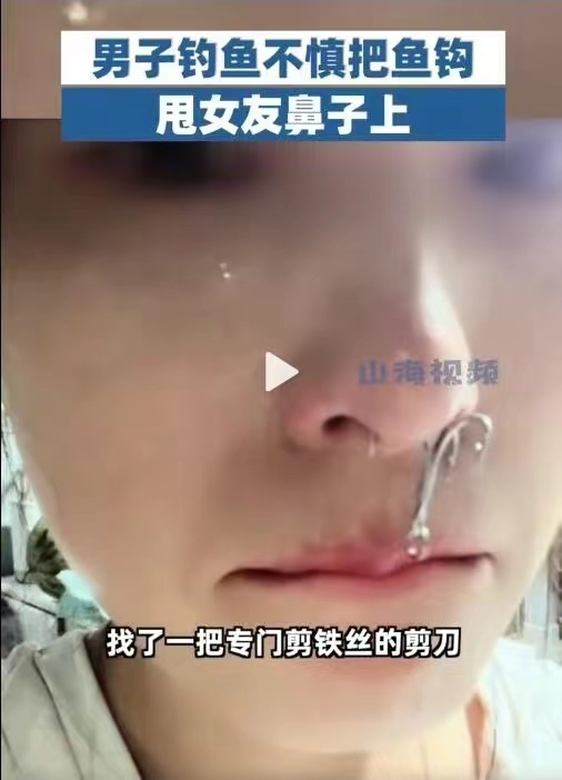 不小心把鱼钩钓到女友鼻子上,夜钓甩竿