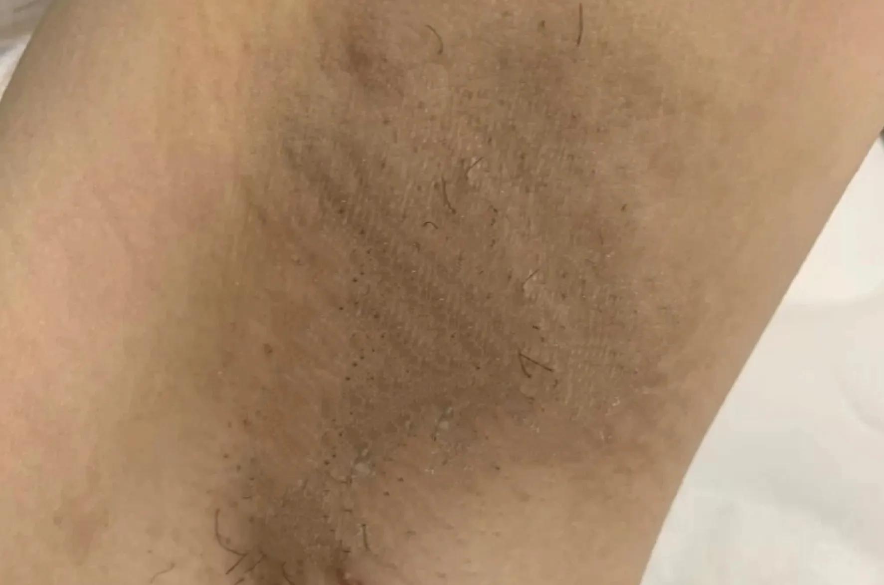 止汗露腋下排行榜第一名测评,口碑最好十大止汗露