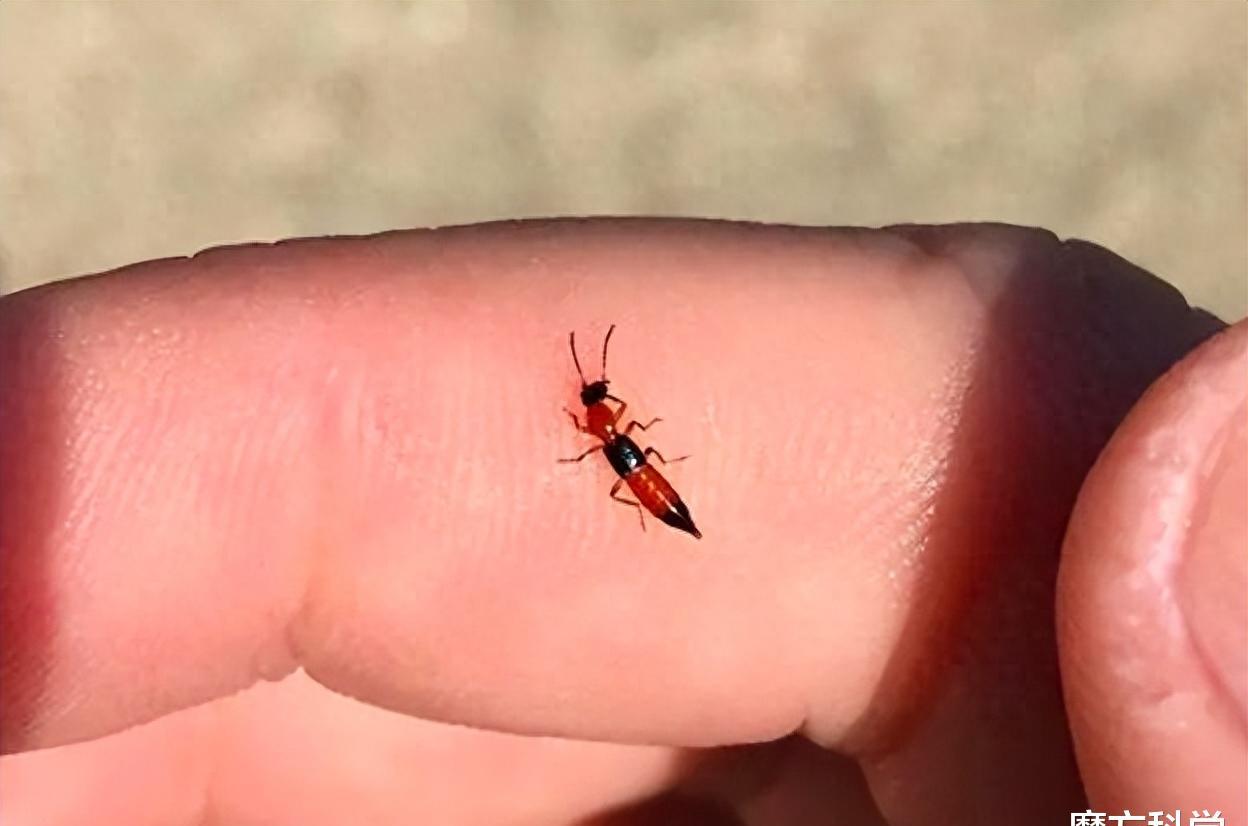 硫酸虫咬了怎么处理,硫酸虫导致皮肤损伤处理