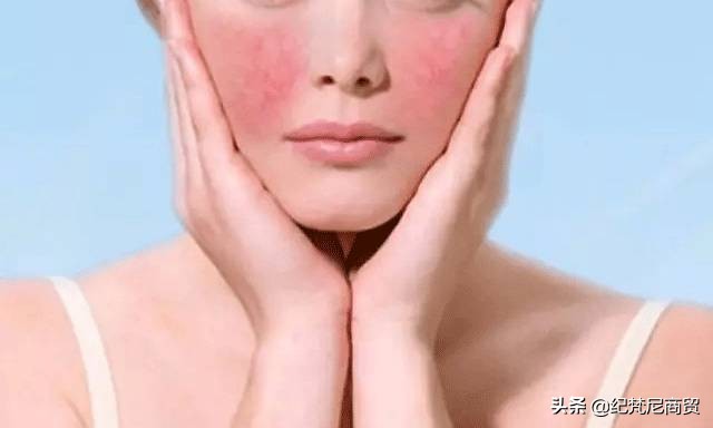 脸皮肤敏感遇热发红怎么办,皮肤敏感脸蛋泛红是什么原因