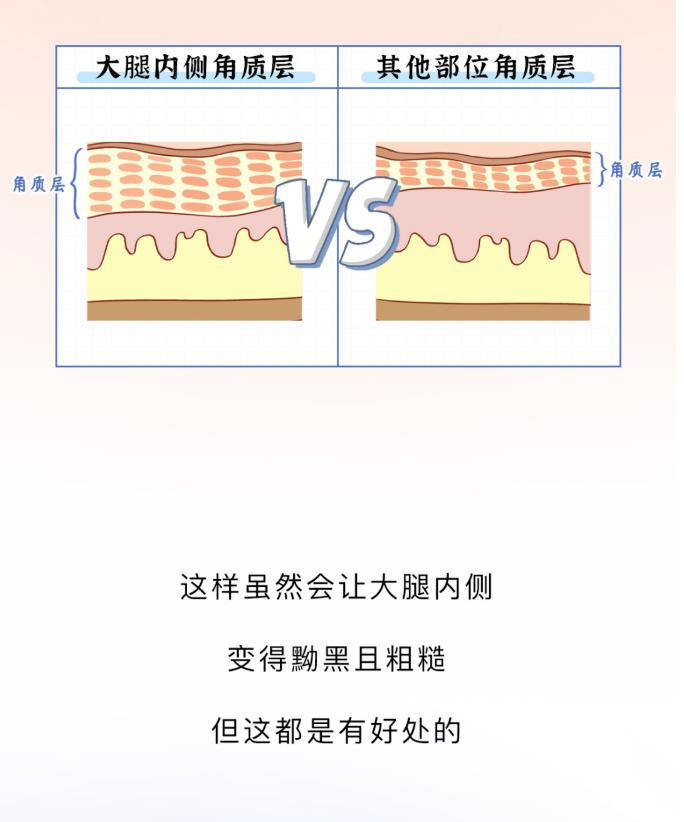 大腿里侧发黑发痒怎么办,大腿两侧发痒变黑用什么药