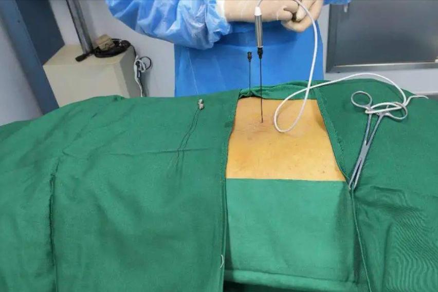 腰椎间盘突出是什么原因引起的,腰椎间盘突出症状表现3d动画