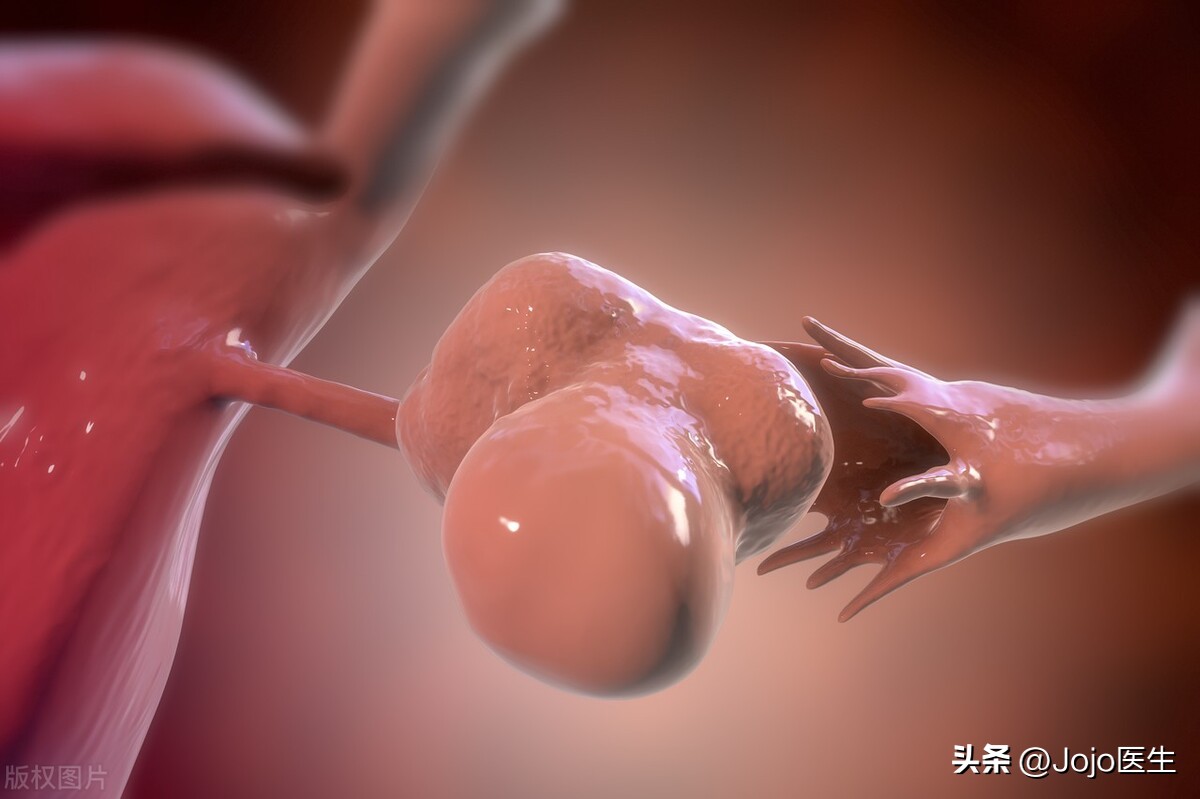 多囊卵巢综合症可以生酮饮食吗,多囊卵巢综合症饮食应该注意哪些