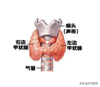 亚急性甲状腺炎的病因、诊断及治疗方法