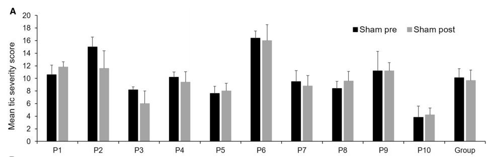 经颅磁刺激治疗抽动症的效果,经颅磁治疗抽动症的效果
