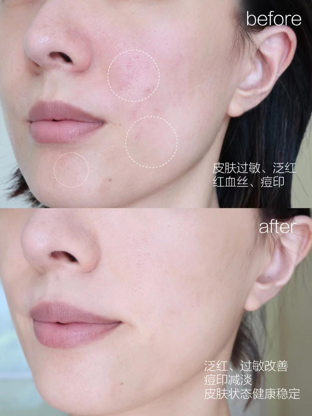 哪款精华液抗皱最好用,50岁左右女性适合什么精华液