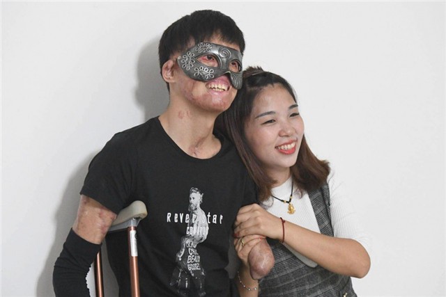 新郎救火时毁容新娘依然嫁给了他,新郎被烧伤新娘前往医院