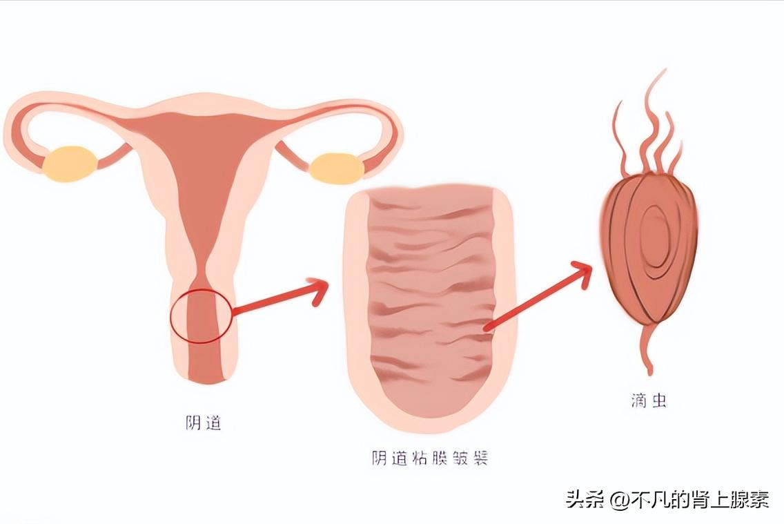 这些妇科病，还真的和伴侣有关