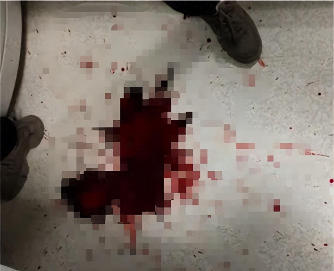 临终老人被强行抢救,癌症晚期昏迷插胃管