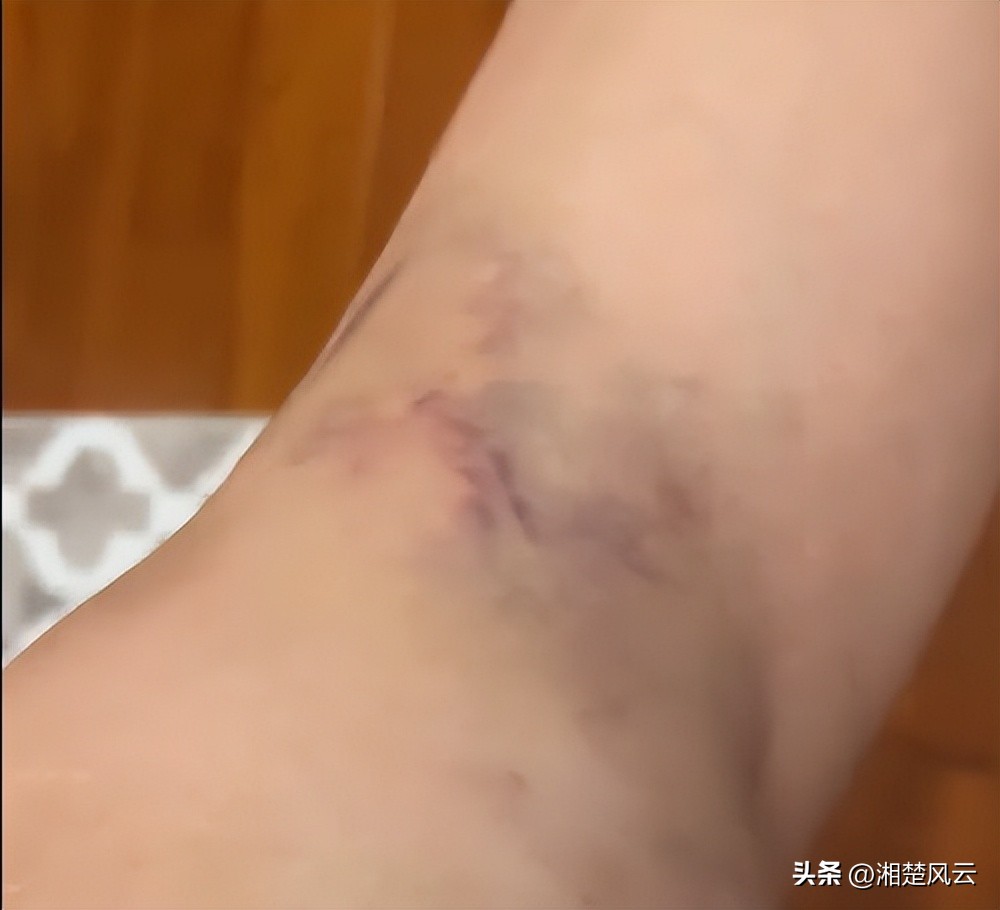 刘晏含做康复训练,刘晏含腿部力量