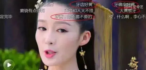 吴宣仪大龅牙,吴宣仪牙不修复吗