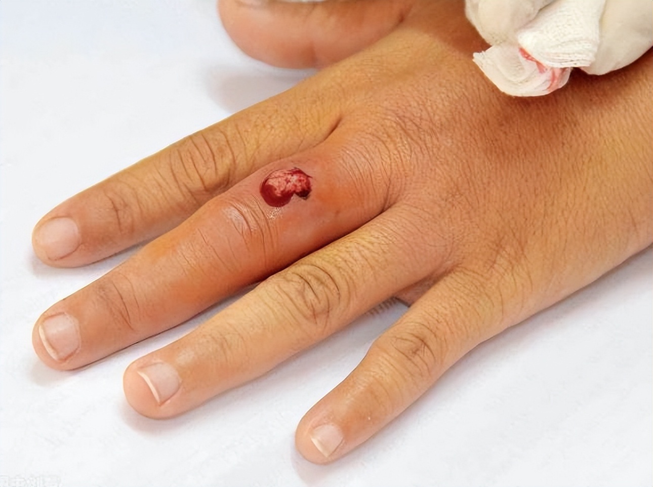 甲硝唑可以用一克吗,一瓶甲硝唑几块钱