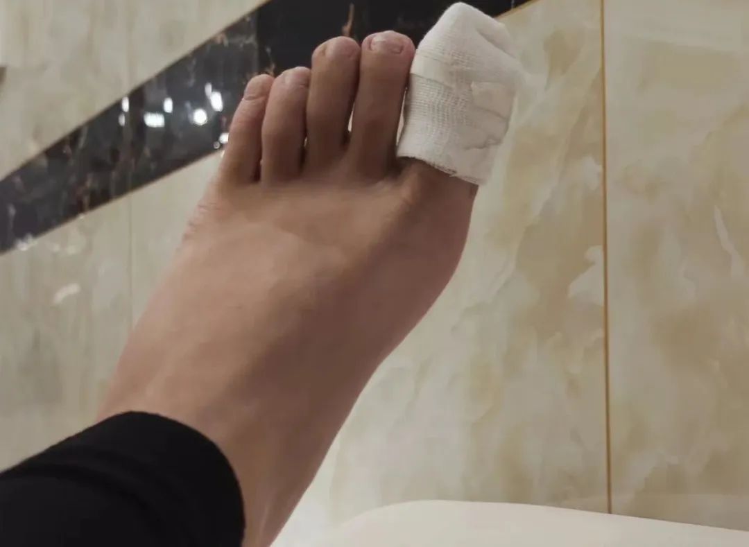 马桶密封圈渗水怎么修,马桶密封圈渗水原因有哪些