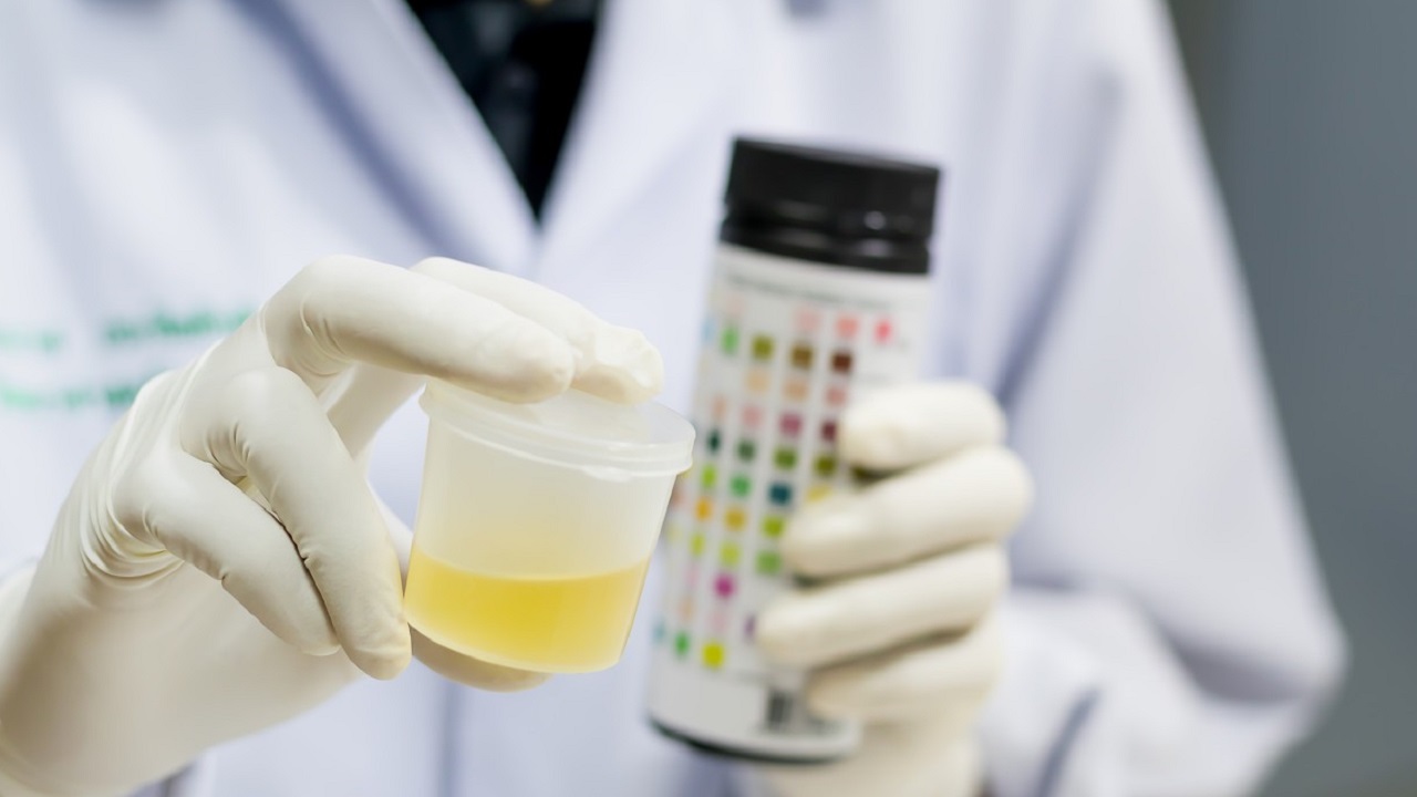 腰不疼尿血怎么回事,腰有点痛出现血尿是什么原因