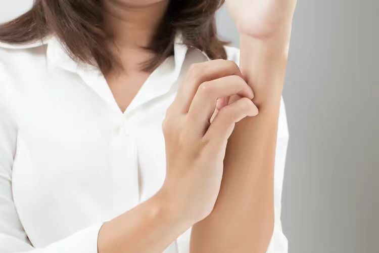 缓解皮肤瘙痒外用的中草药,止痒最快皮肤喷剂荨麻疹