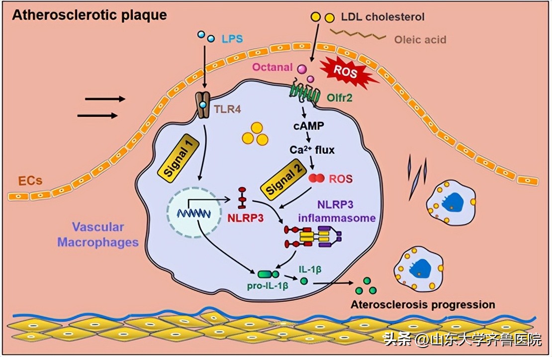 山东大学齐鲁医院心血管实验室基础研究取得系列重大进展