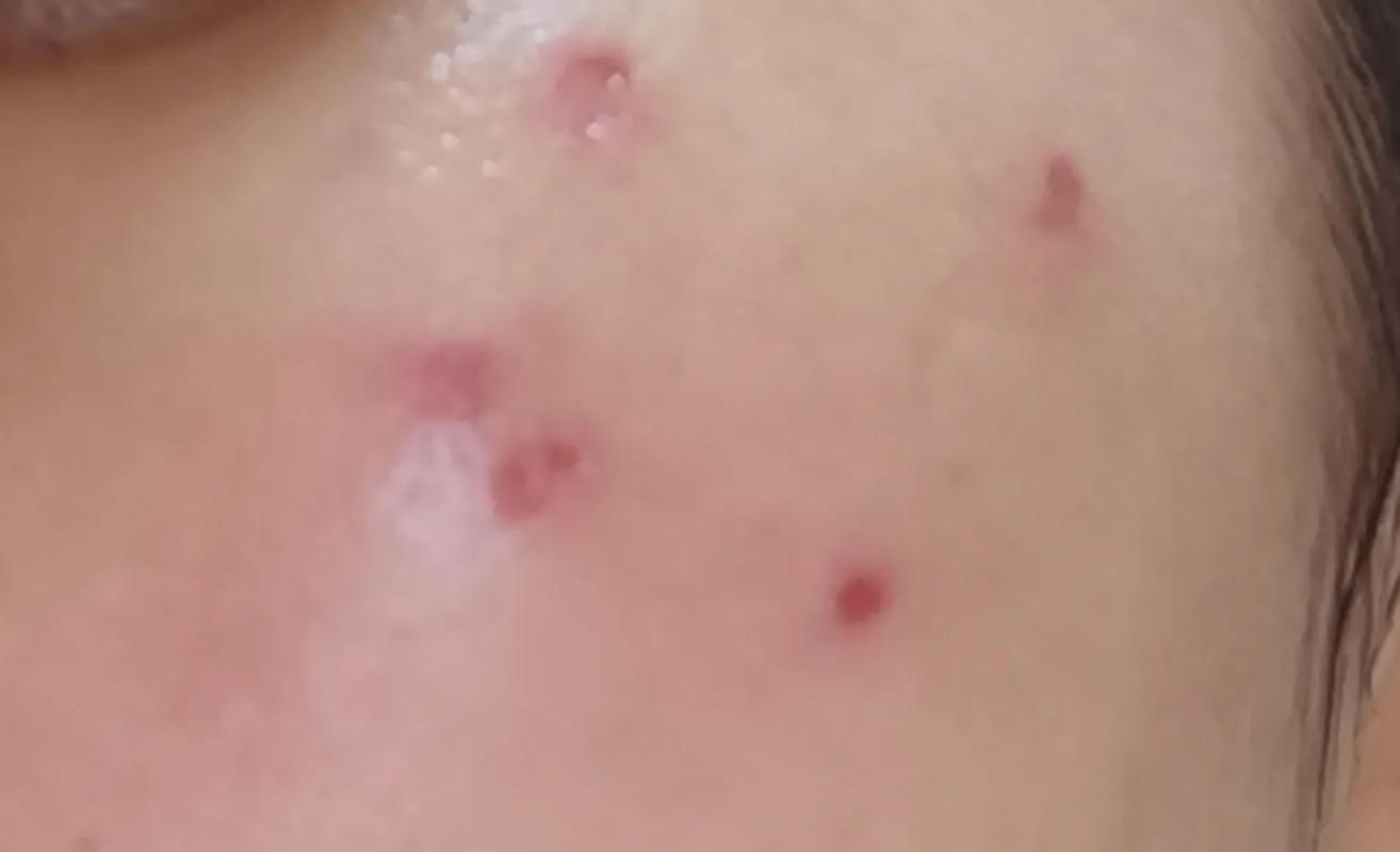 医院里的皮肤美容科靠谱吗,美容院做皮肤护理毁容怎么办