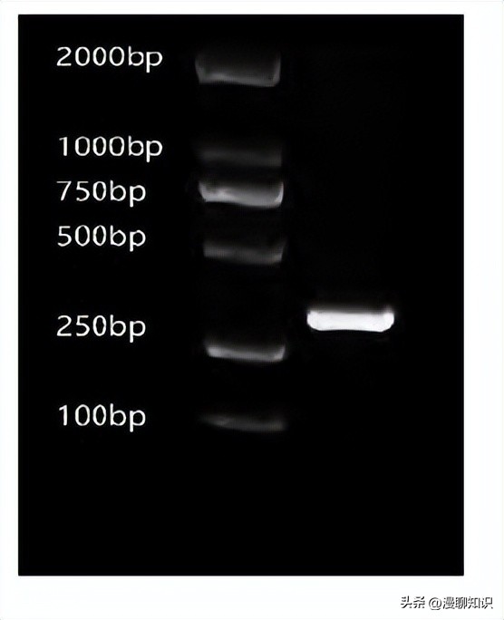 猫会感染人的疾病的图片,猫病毒检测cpr可以测出什么病毒