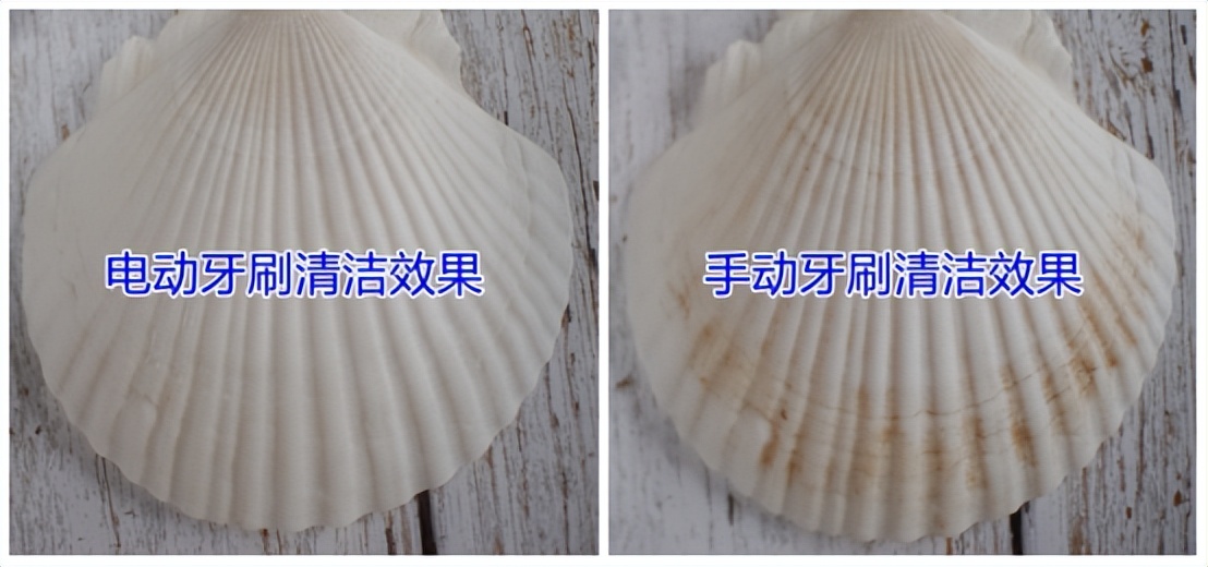 电动牙刷会不会对补的牙有所伤害,小米声波电动牙刷伤牙齿吗